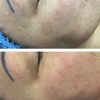 Александра Бевз, Одеса Фото - 8