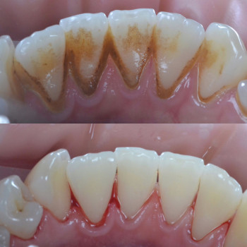 Аліна Степанюк, Рівне Фото - 21