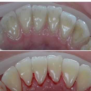 Аліна Степанюк, Рівне Фото - 22