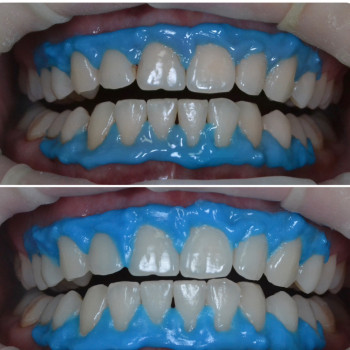 Аліна Степанюк, Рівне Фото - 23