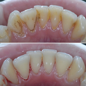 Аліна Степанюк, Рівне Фото - 25