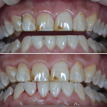 Аліна Степанюк, Рівне Фото - 26