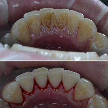 Аліна Степанюк, Рівне Фото - 27