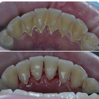 Аліна Степанюк, Рівне Фото - 28