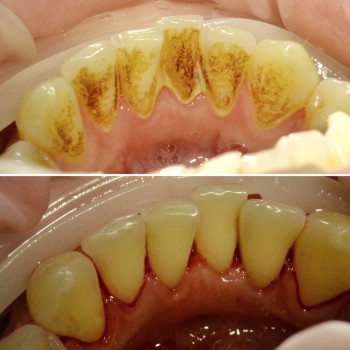 Аліна Степанюк, Рівне Фото - 29