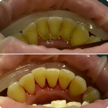 Аліна Степанюк, Рівне Фото - 31