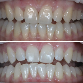 Аліна Степанюк, Рівне Фото - 32