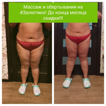Лимфодренажный массаж блейдами без боли и синяков!
                    Масажист/ Енерготерапевт Ирина Харьков