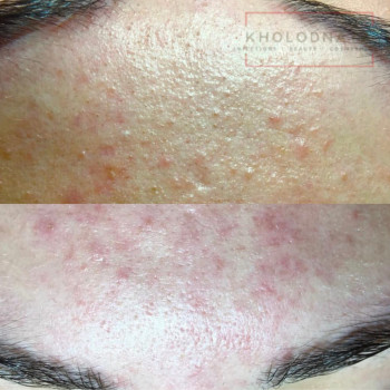 Аліна Холодна, Киев Фото - 27