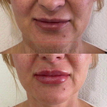 Аліна Холодна, Киев Фото - 28