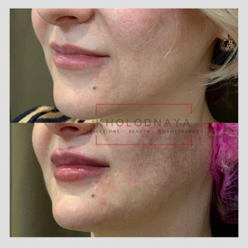 Аліна Холодна, Киев Фото - 29