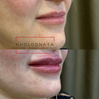 Аліна Холодна, Киев Фото - 31