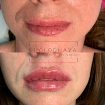 Аліна Холодна, Киев Фото - 32