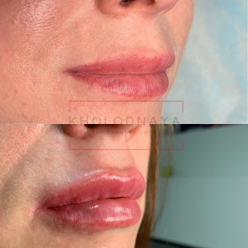 Аліна Холодна, Киев Фото - 33