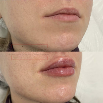 Аліна Холодна, Киев Фото - 34