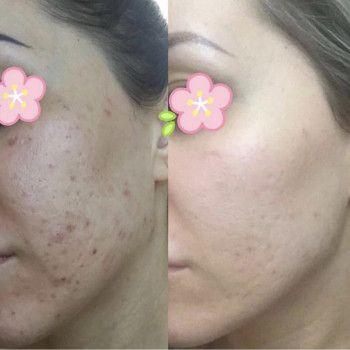 Владлена Ломко, Киев Фото - 5