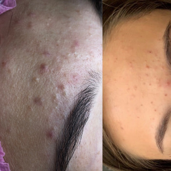 Владлена Ломко, Киев Фото - 36