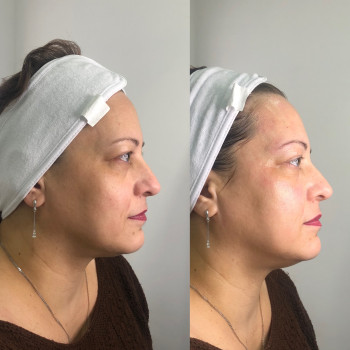 Владлена Ломко, Киев Фото - 53