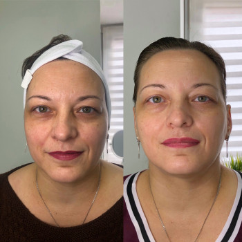 Владлена Ломко, Киев Фото - 60