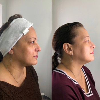 Владлена Ломко, Киев Фото - 61