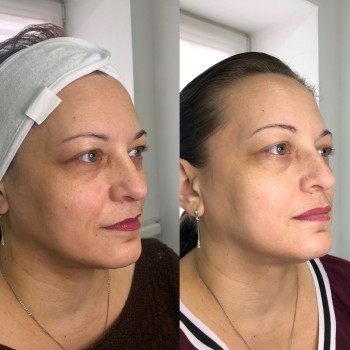 Владлена Ломко, Киев Фото - 64