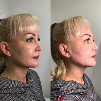 Владлена Ломко, Киев Фото - 65