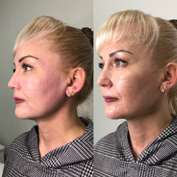 Владлена Ломко, Киев Фото - 67