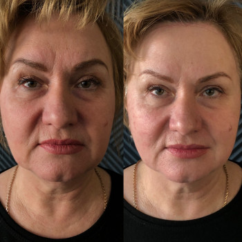 Владлена Ломко, Киев Фото - 68