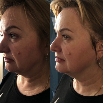 Владлена Ломко, Киев Фото - 69