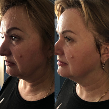 Владлена Ломко, Киев Фото - 70