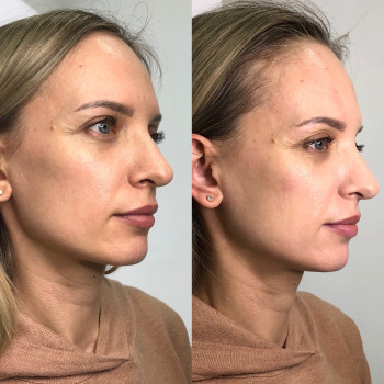 Владлена Ломко, Киев Фото - 71