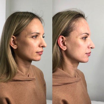 Владлена Ломко, Киев Фото - 75