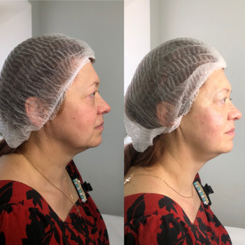 Владлена Ломко, Киев Фото - 81