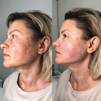 Владлена Ломко, Киев Фото - 87