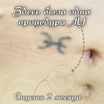 Роман Voroschuk, Кропивницкий Фото - 16