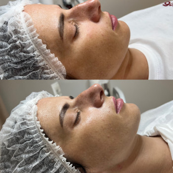 Дар’я Гайдай, Винница Фото - 7