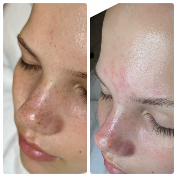 Дар’я Гайдай, Винница Фото - 16