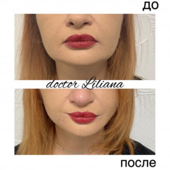 Доктор Лилиана, Одесса Фото - 45