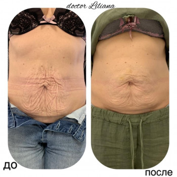 Доктор Лилиана, Одесса Фото - 48