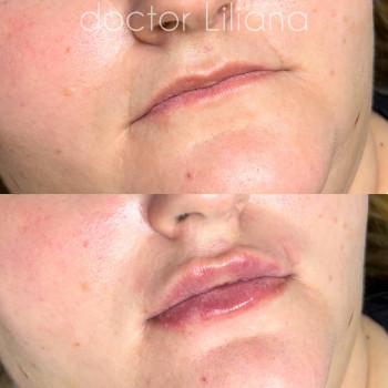 Доктор Лилиана, Одесса Фото - 49