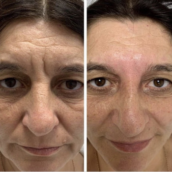 Доктор Лилиана, Одесса Фото - 55