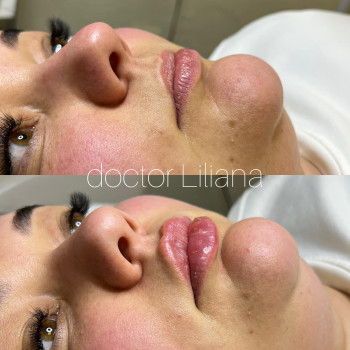 Доктор Лилиана, Одесса Фото - 57