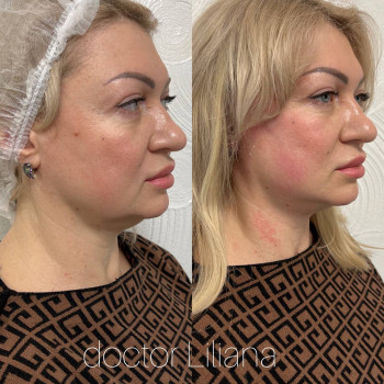 Доктор Лилиана, Одесса Фото - 64