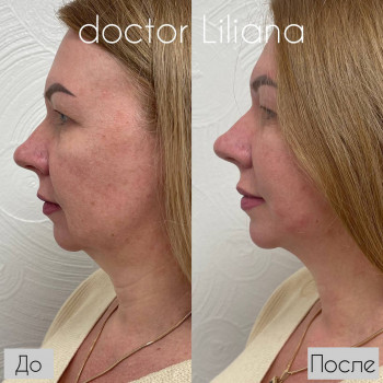 Доктор Лилиана, Одесса Фото - 65