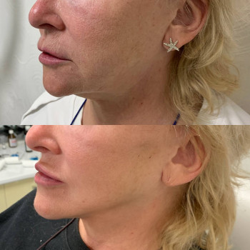 Доктор Лилиана, Одесса Фото - 75