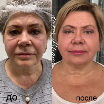 Доктор Лилиана, Одесса Фото - 77