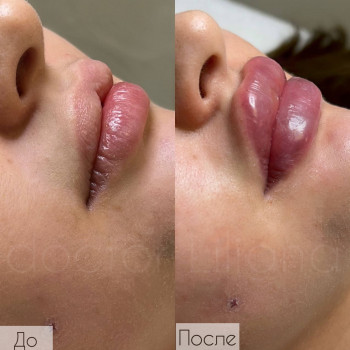 Доктор Лилиана, Одесса Фото - 82