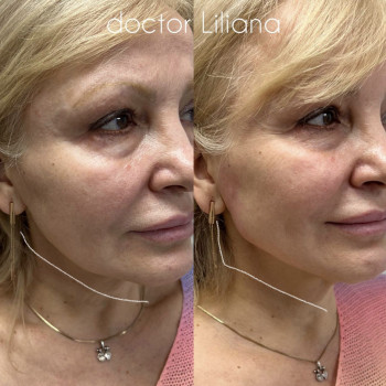 Доктор Лилиана, Одесса Фото - 89