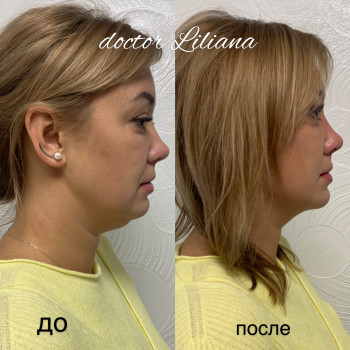 Доктор Лилиана, Одесса Фото - 91