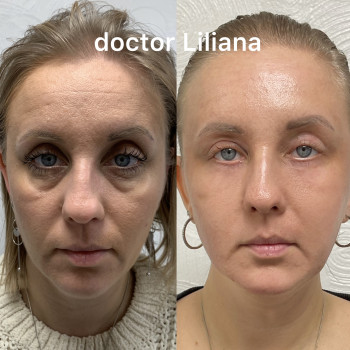 Доктор Лилиана, Одесса Фото - 93